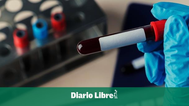 Hemofilia, enfermedad que dificulta la coagulación de la sangre